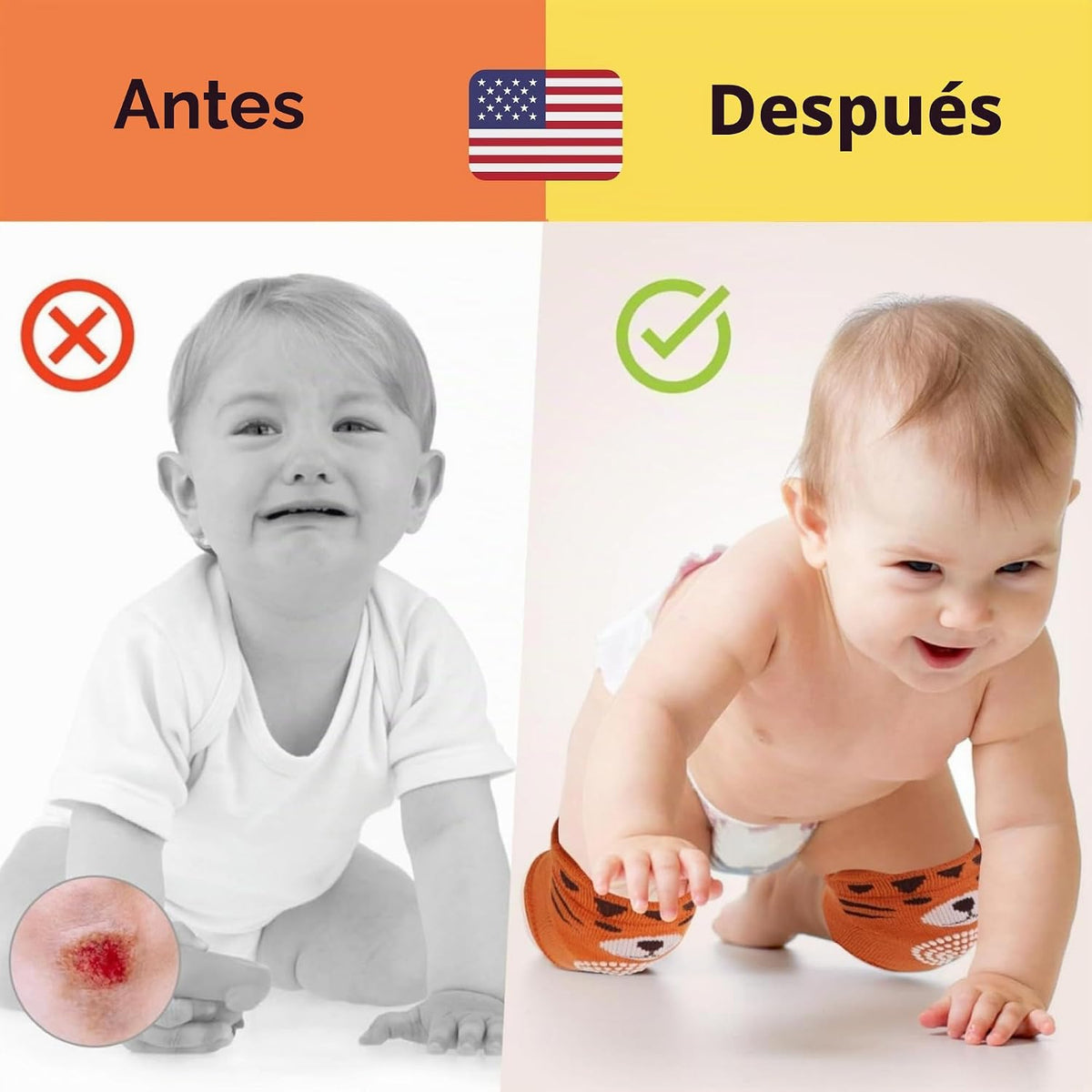 Rodilleras antideslizantes para gatear bebés, mochila de protección...