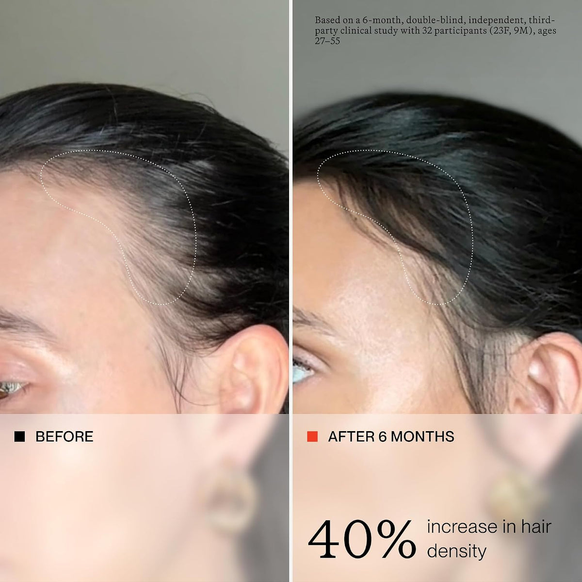oneskin OS-01 HAIR Peptide Scalp Serum | Reduce la caída y apoya la...
