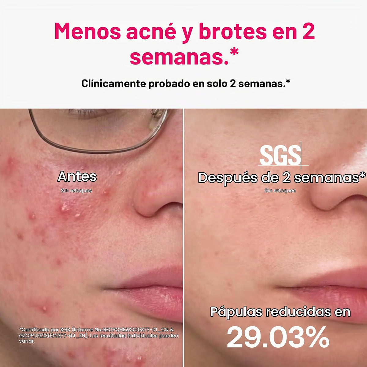 Máscara de terapia de luz roja Ulike para rostro, cobertura facial...