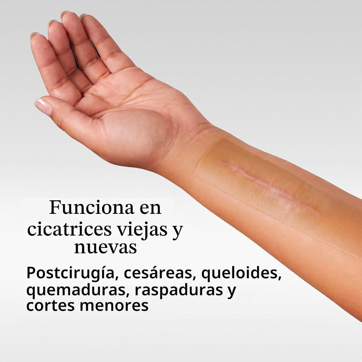 NUVADERMIS Hojas de silicona para cicatrices \u2013 Hojas de cicatr...
