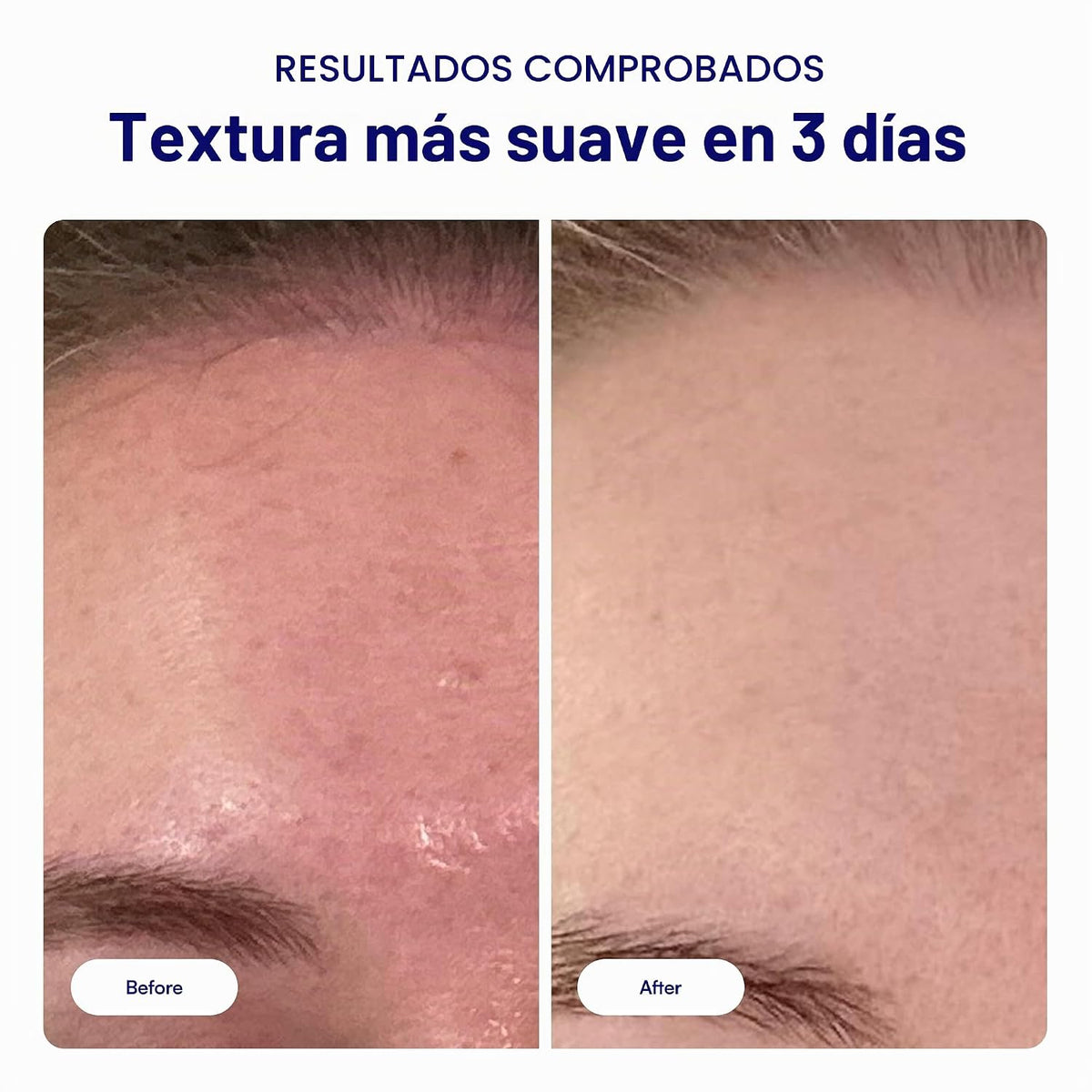 Bliss That's Incredi-Peel - Almohadillas faciales renovadoras c...