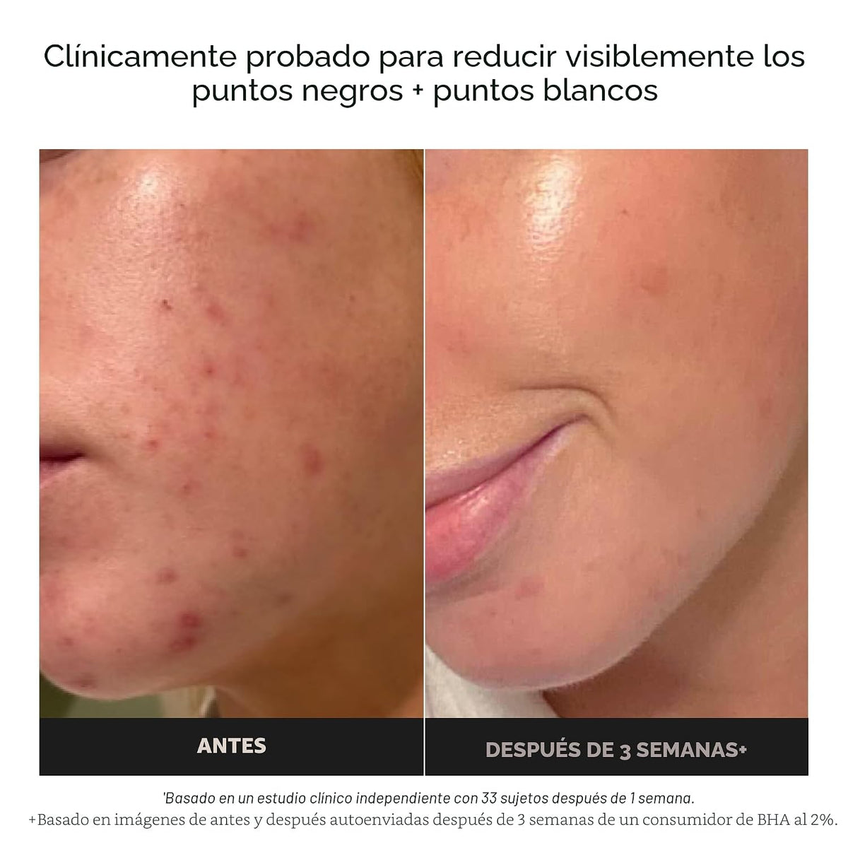 Paula's Choice SKIN PERFECTING 2% BHA Exfoliante líquido sin enjuag...