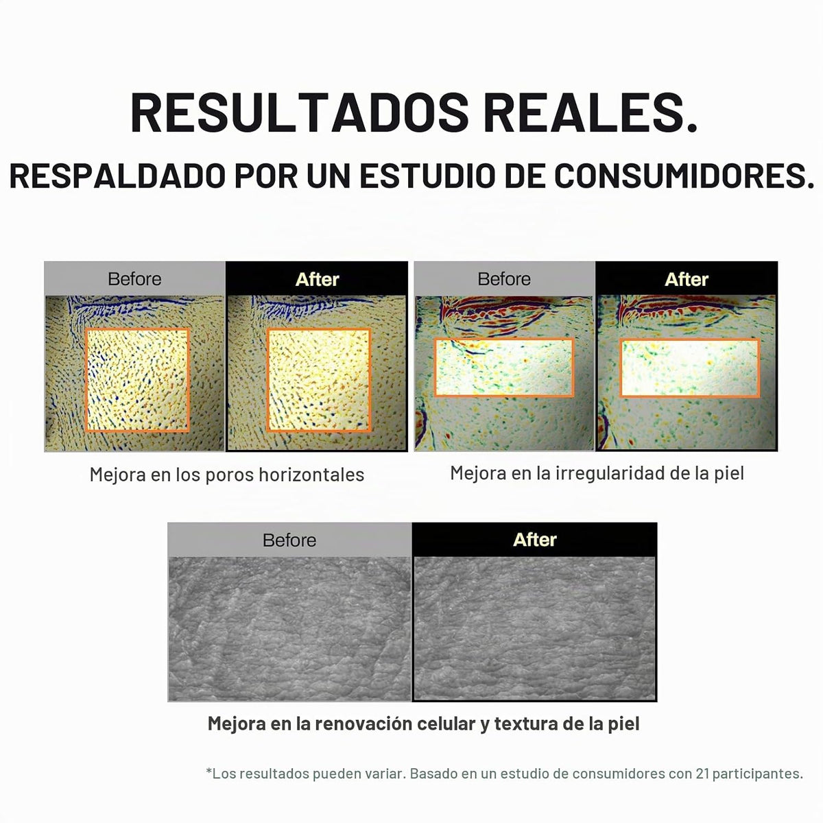 MEDITHERAPY Crema de refuerzo para la piel de retina blanca coreana...