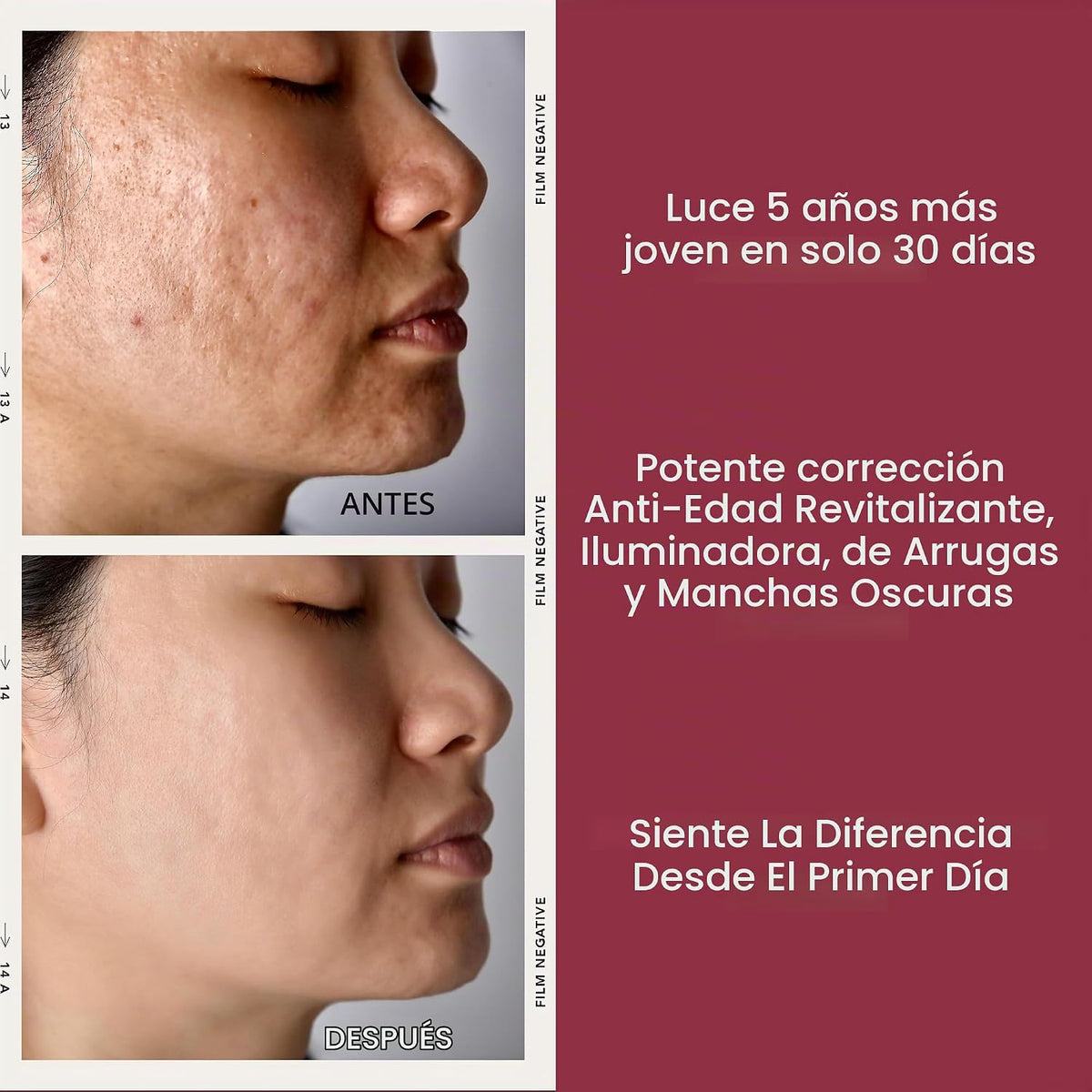 TURBINNE Cápsulas de suero de retinol puro al 2.5%. Luce 5 años más...