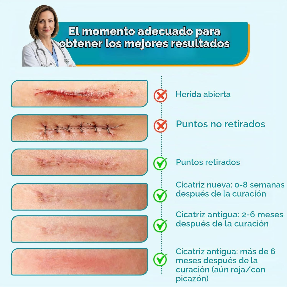 Dimora - Hojas de silicona para cicatrices de grado médico, rollo d...
