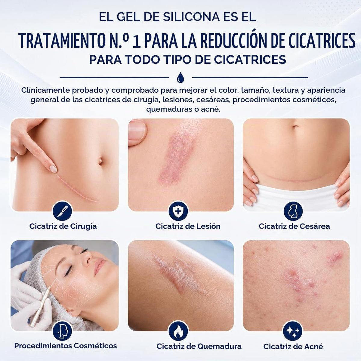 Gel de cicatriz 100% silicona crema para cicatrices \u2013 Gel avan...