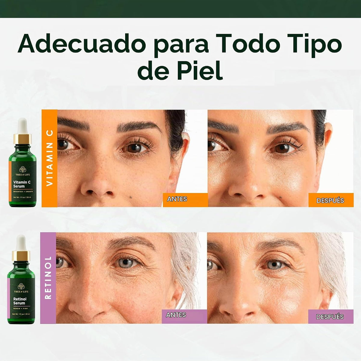 Tree of Life Advanced Régimen - 2 onzas - Suero de niacinamida (Ref...