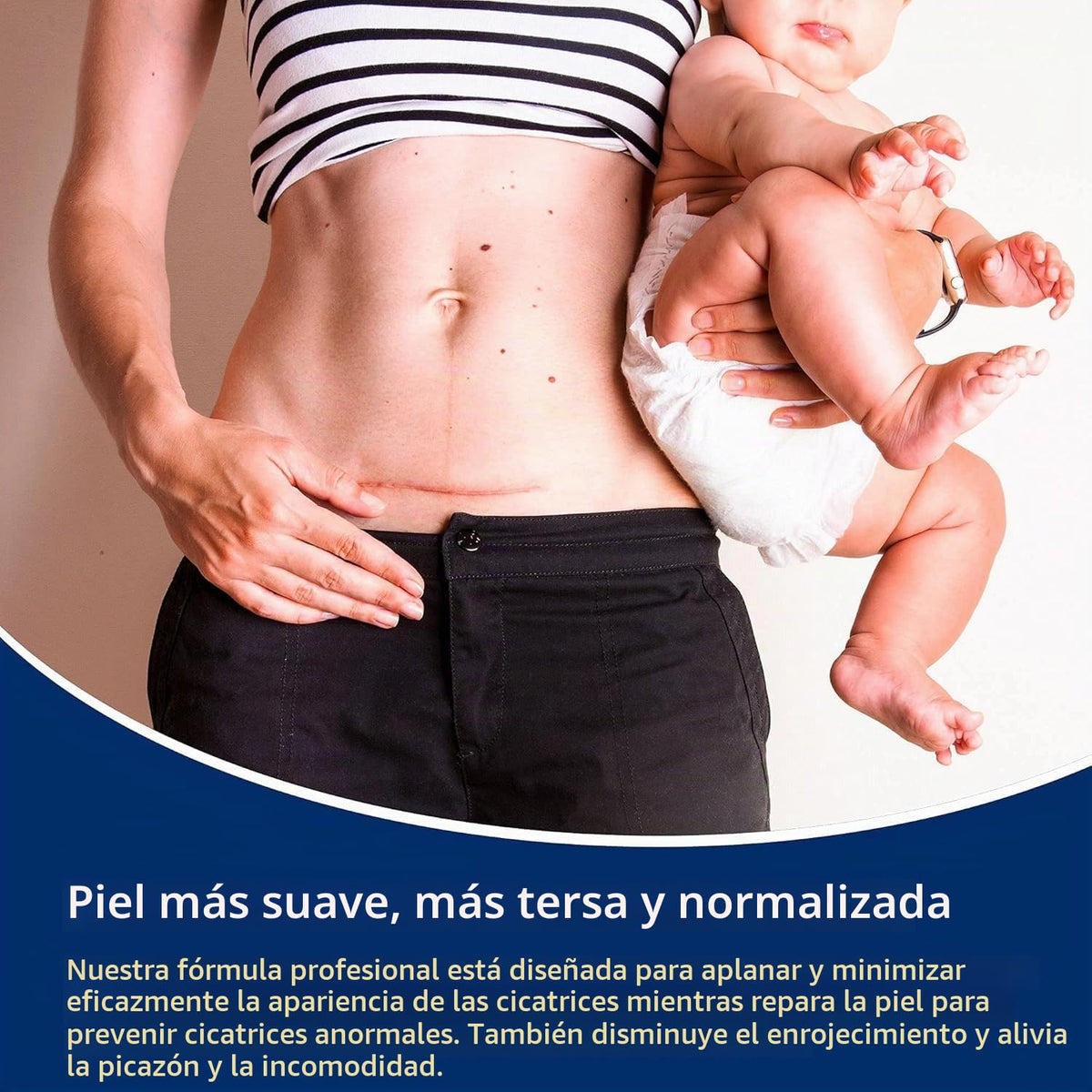 Gel 100% silicona para cicatrices, paquete de 3 \u2013 3 x 1.06oz c...