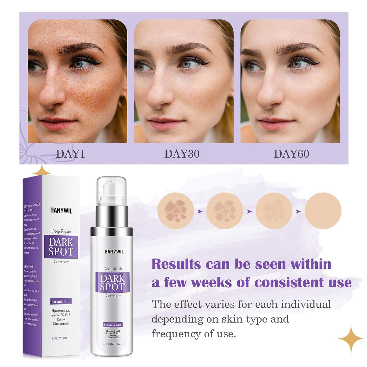 HANYWIL Eliminador de manchas oscuras para suero facial y corporal,...