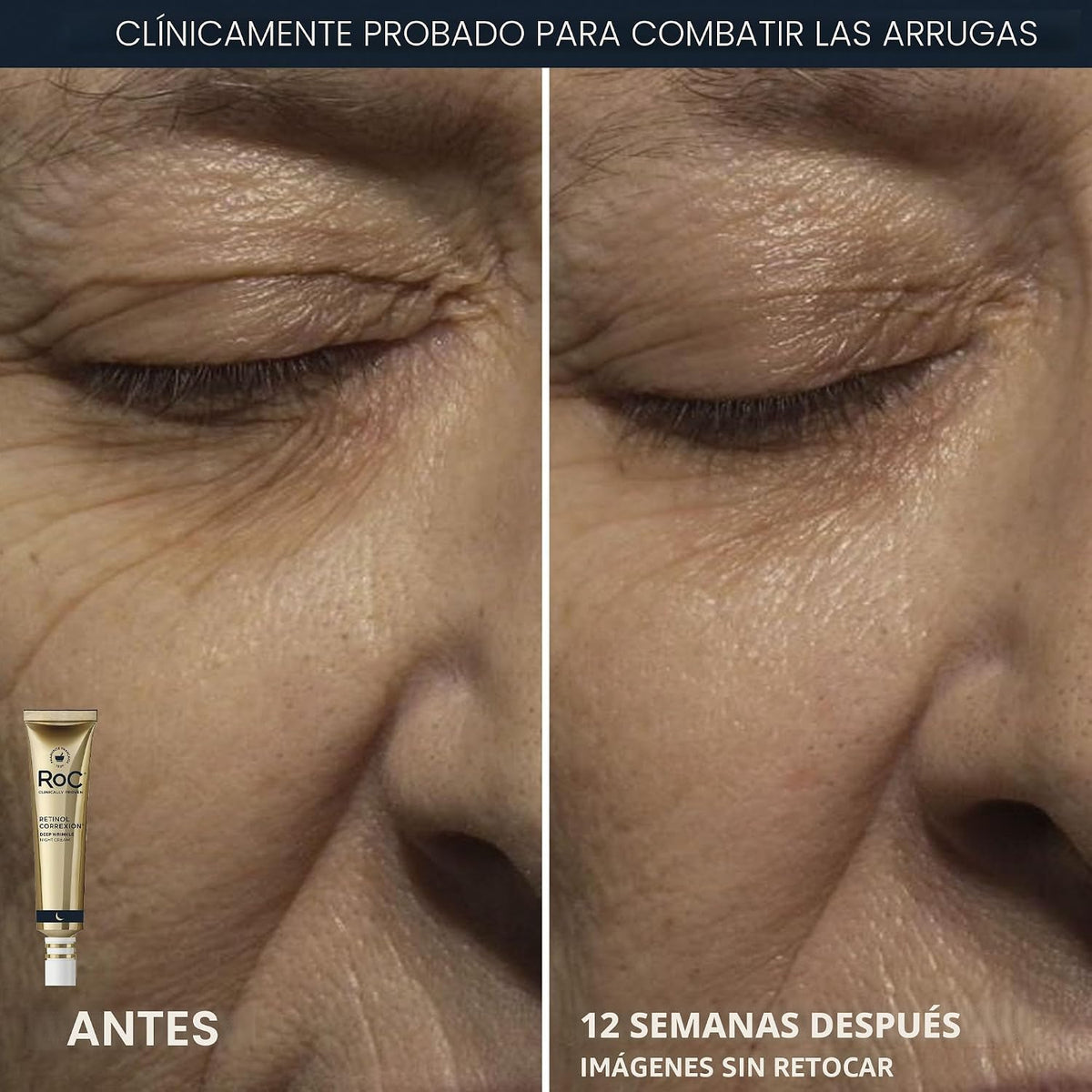 RoC conjunto de reparación de arrugas profundas, corrección con ret...