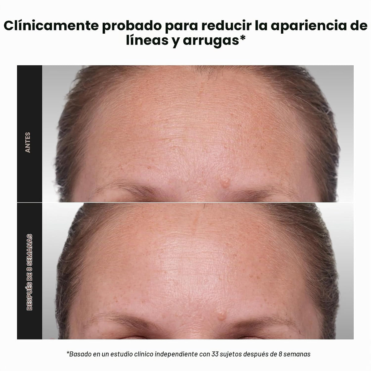 Paula's Choice CLÍNICA 1% Retinol Crema Tratamiento | Suero facial...