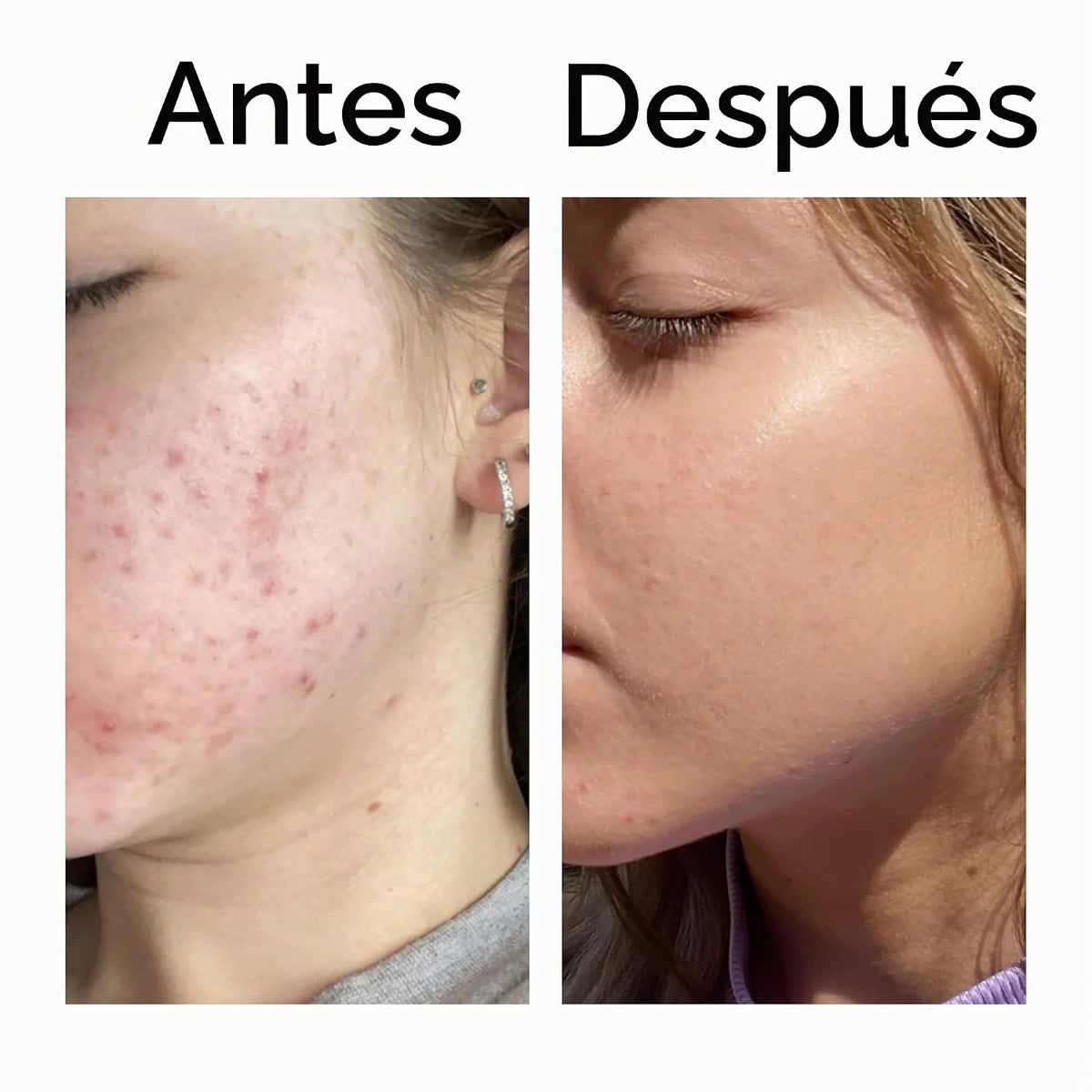 The INKEY List Suero de niacinamida al 10% 1 fl oz | 10% de niacina...