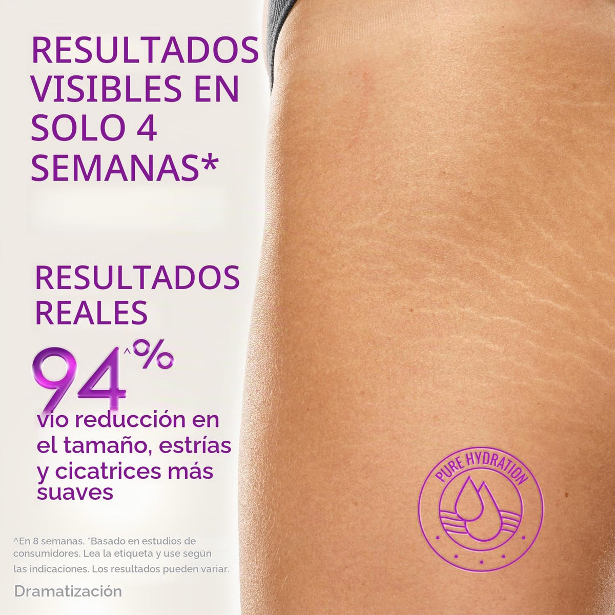 Cicatricure Aceite de cica para estrías y cicatrices, aceite corpor...