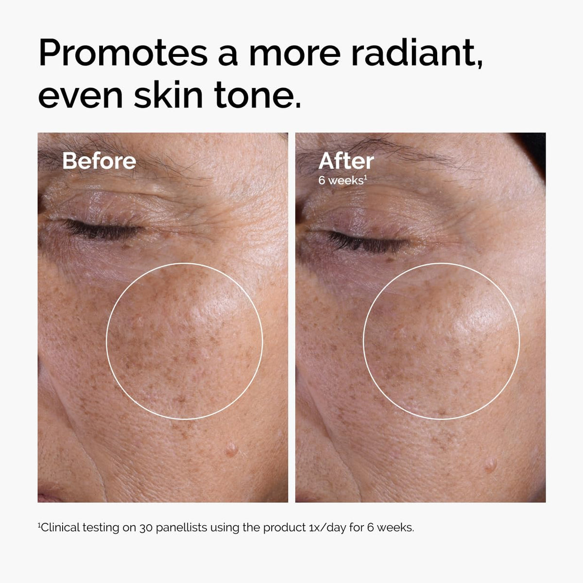 The Ordinary Tónico Exfoliante 7% Ácido Glicólico Tamaño: 3.4 Fl Oz (Pack of 2)