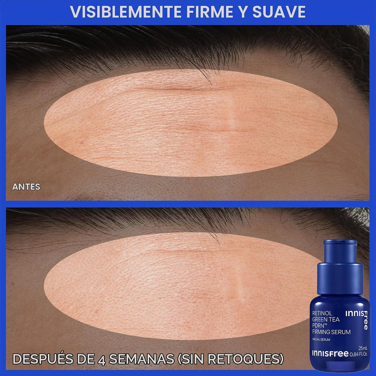 innisfree Suero PDRN de té verde | Cuidado de la piel coreano con r...