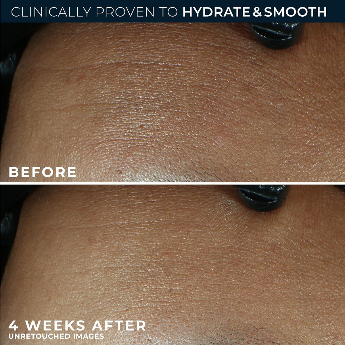 RoC Retinol Correxion Max Hidratación diaria hidratante facial anti...