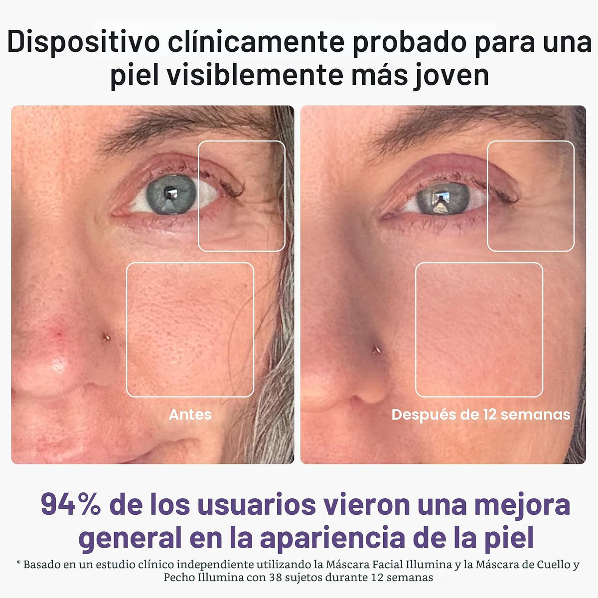 iRestore - Terapia de luz roja para cara, máscara facial LED para a...