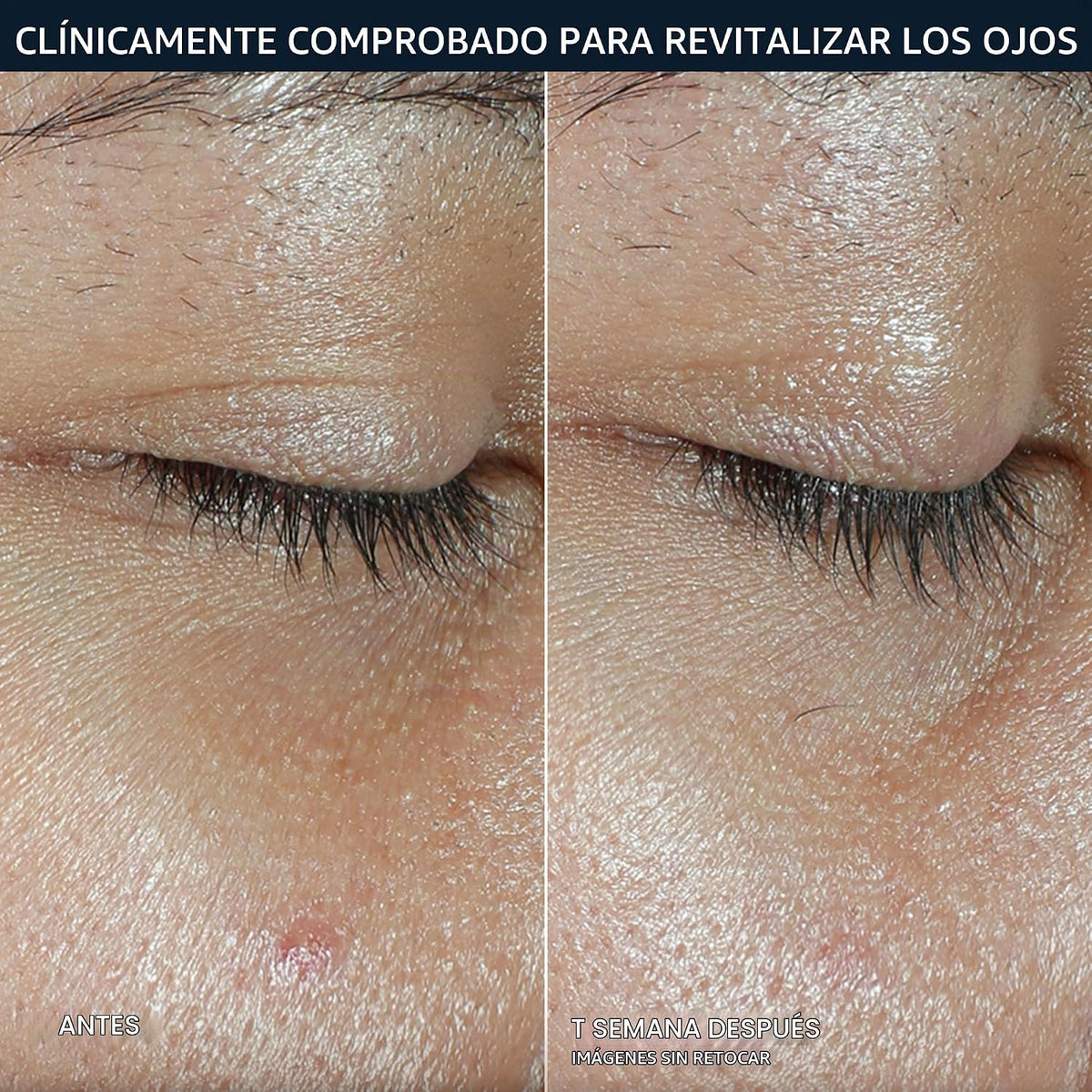 Bálsamo para ojos RoC Multi Correxion con vitamina C, 0.14 oz, crem...