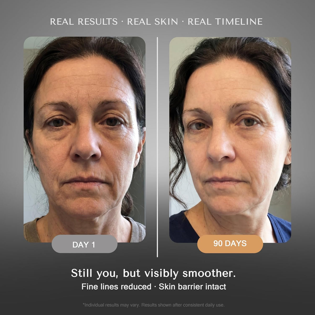 Suero de retinol para arrugas faciales \u2013 Sistema renovador de...