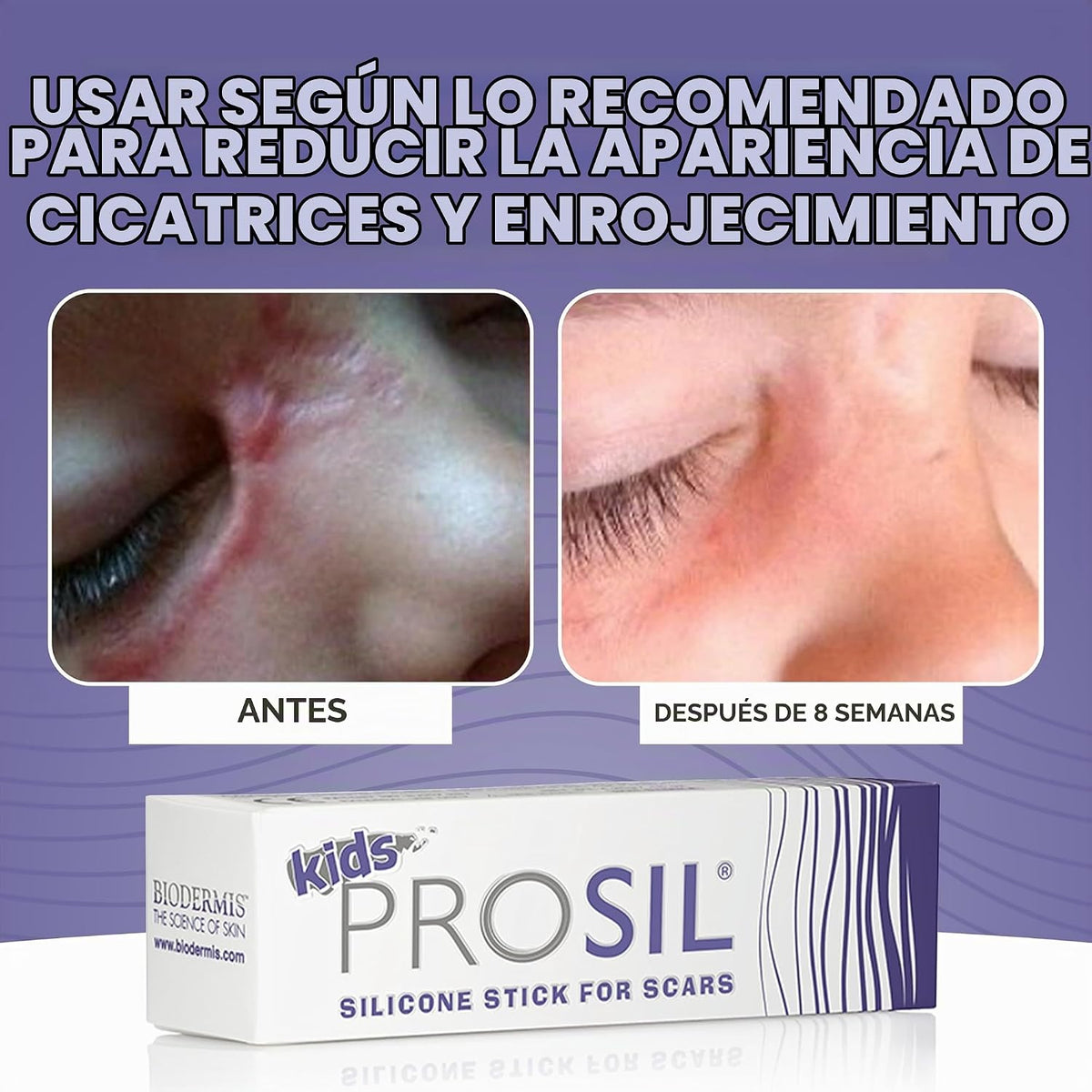 Kids Pro-Sil - Palo de silicona para cicatrices (0.15 oz) | Tratami...