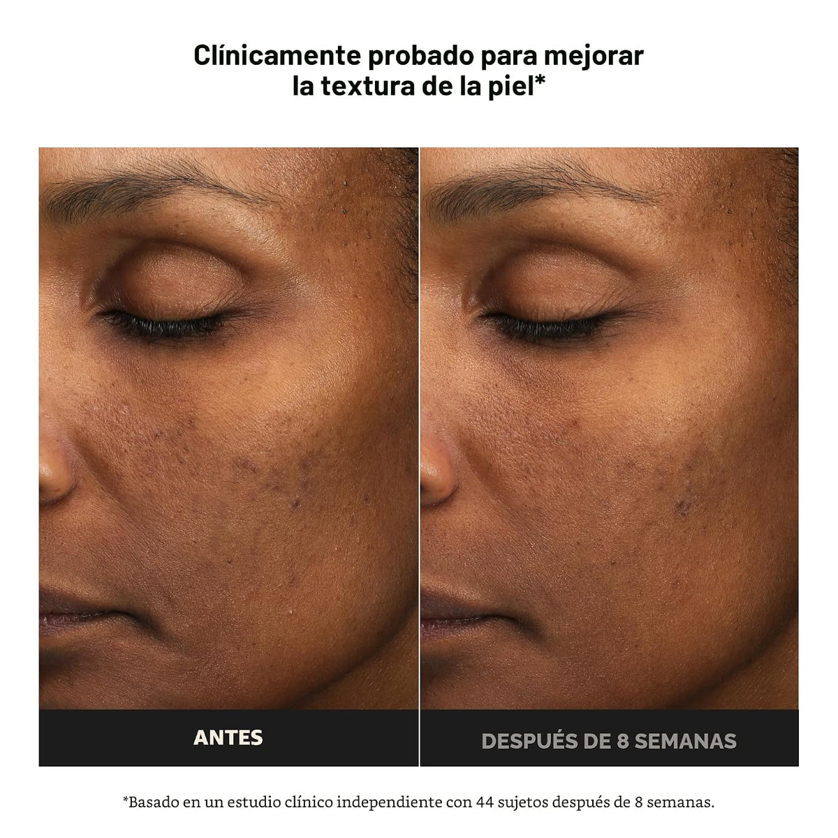 Paula's Choice 6% de ácido mandélico + 2% exfoliante de ácido l...