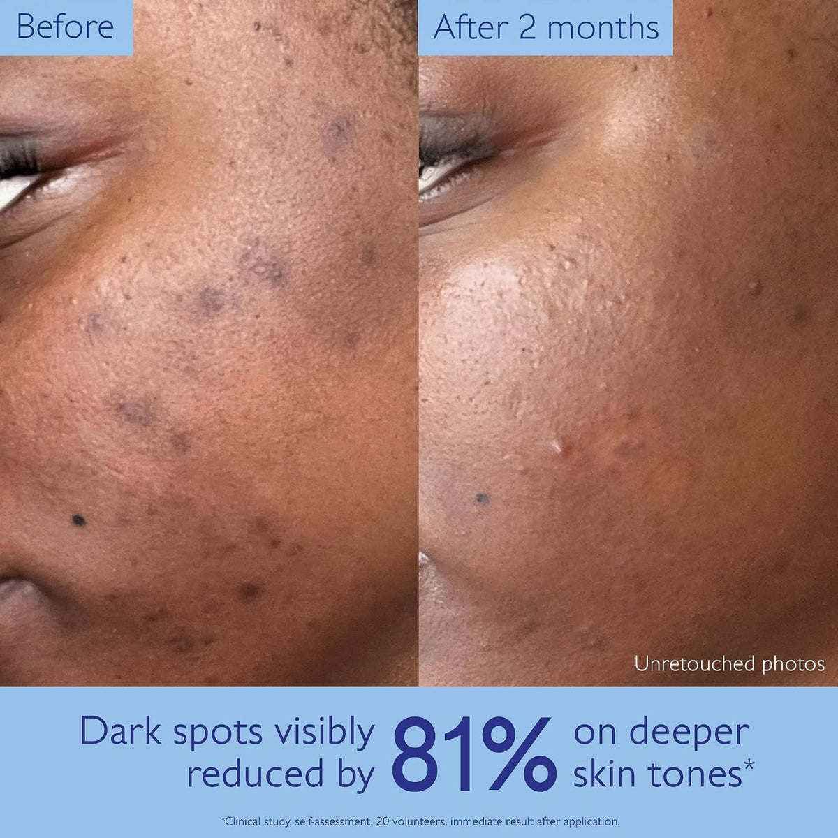 Caudalie Vinoperfect - Suero iluminador de manchas oscuras alternat...