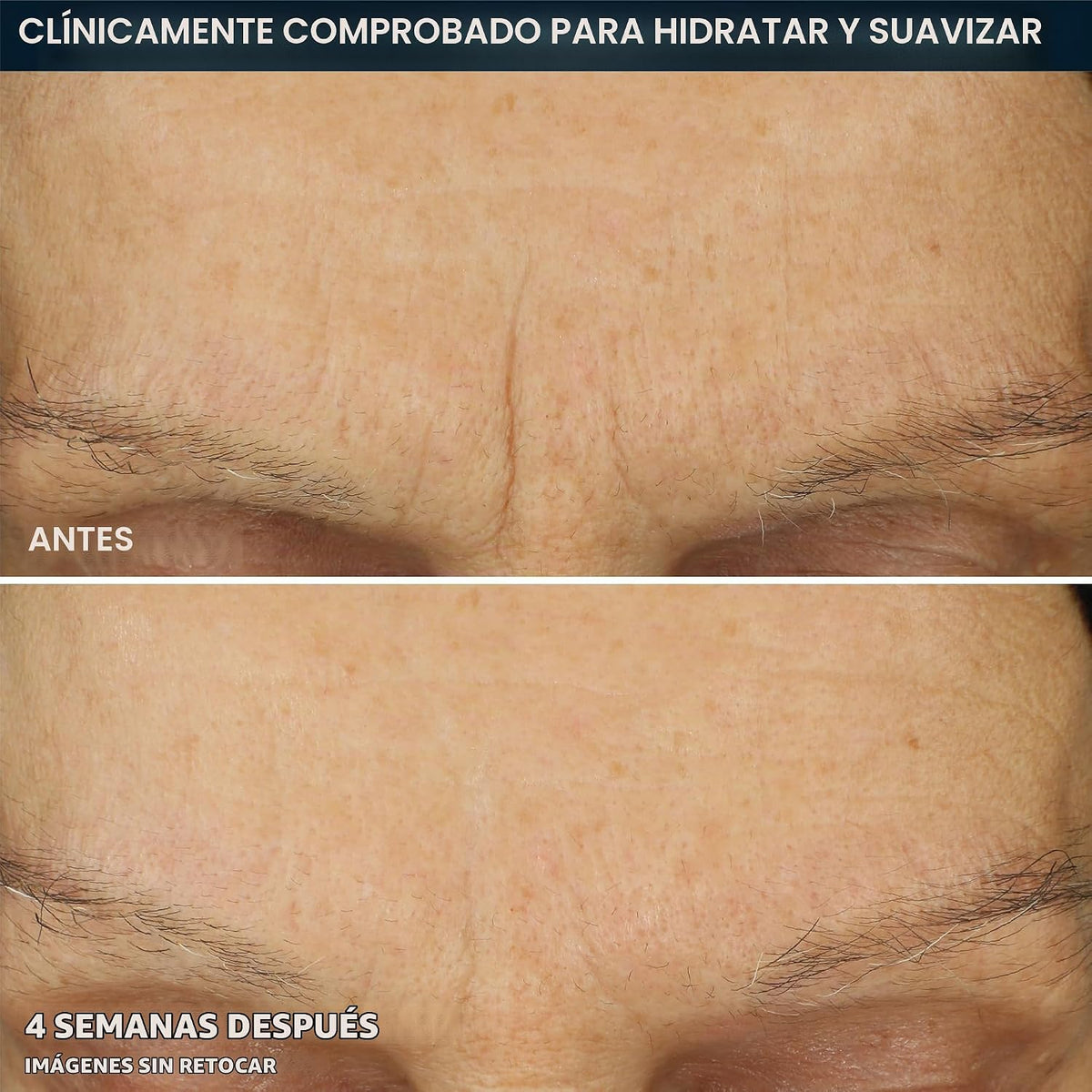 RoC Retinol Correxion Max Hydration - Hidratante facial diario anti...