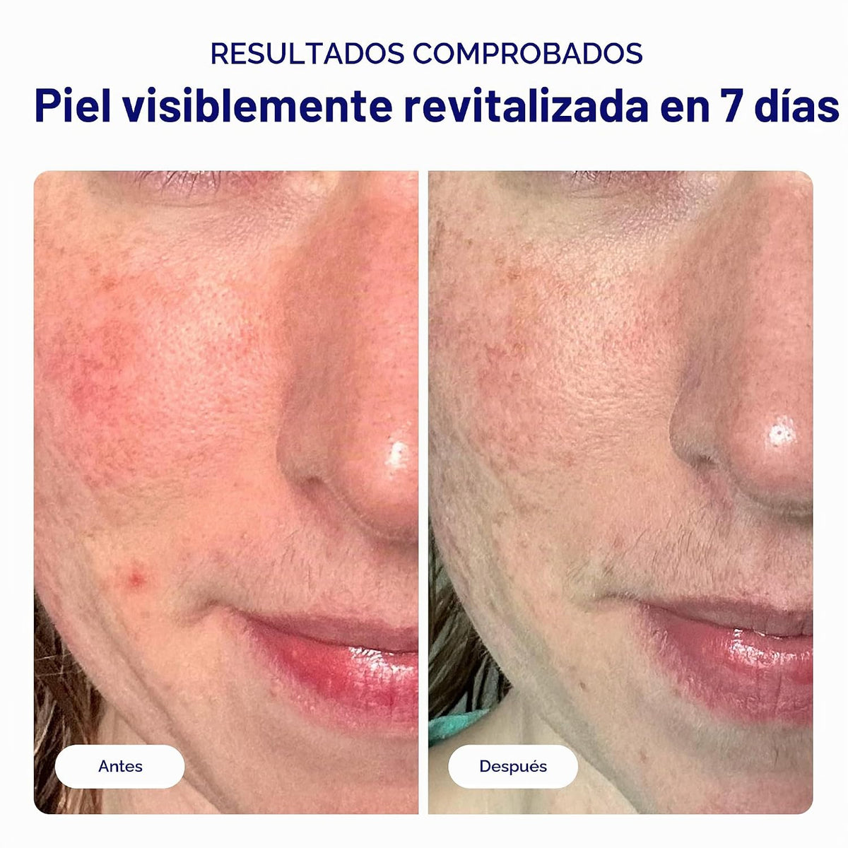 Bliss That's Incredi-Peel - Almohadillas faciales renovadoras c...