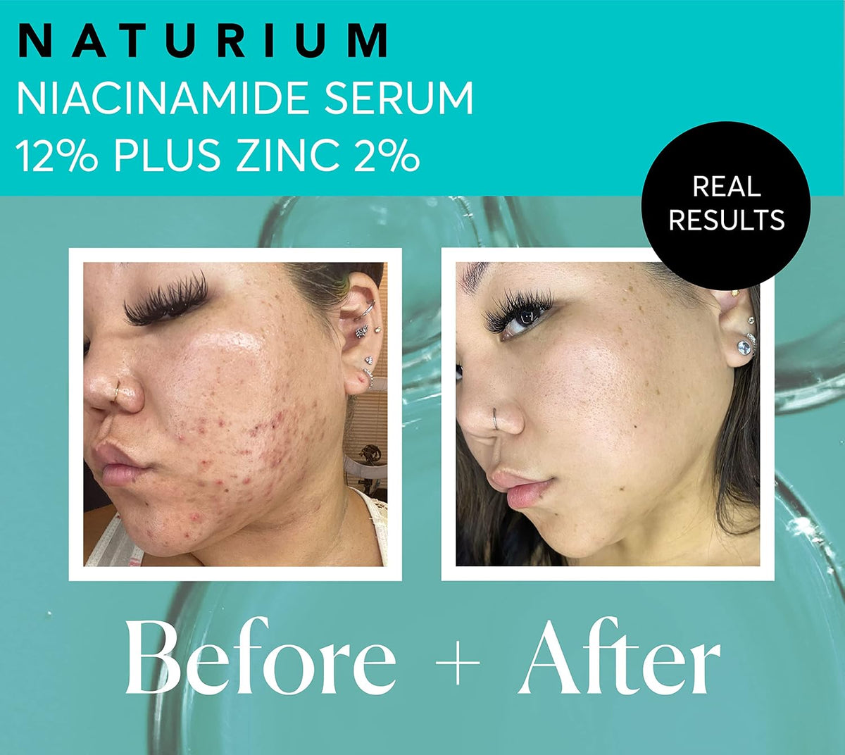 Naturium Suero facial de niacinamida 12% más zinc 2%, antienvejecim...