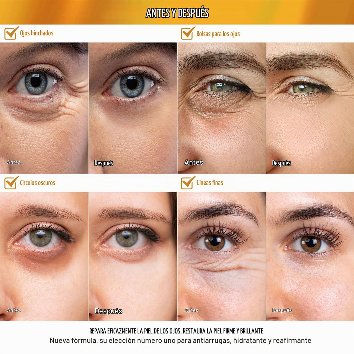 Enaskin Naturals - Parches para debajo de los ojos con círculos osc...