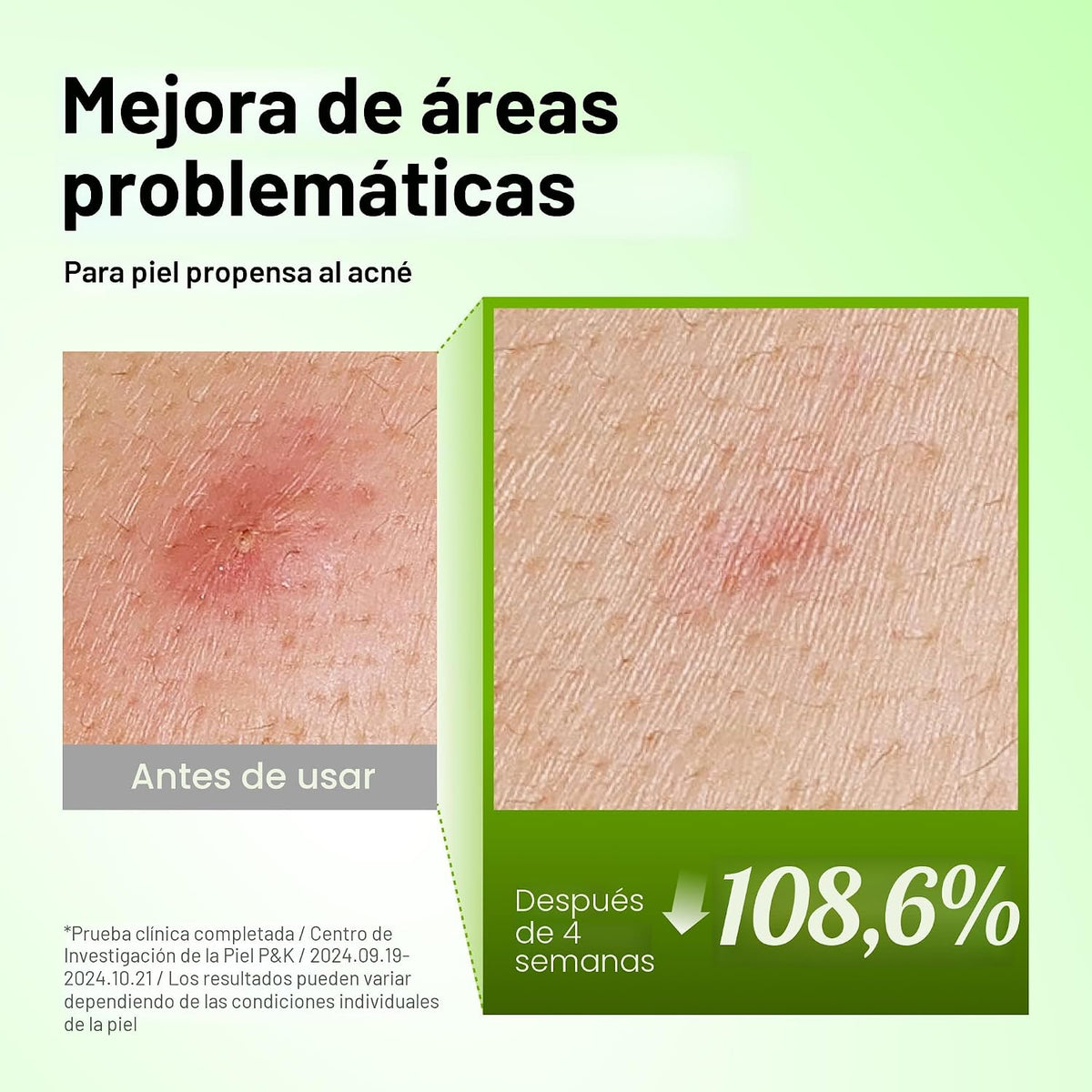 Anua Dúo Radiance Care | Suero calmante de enrojecimiento de ácido...