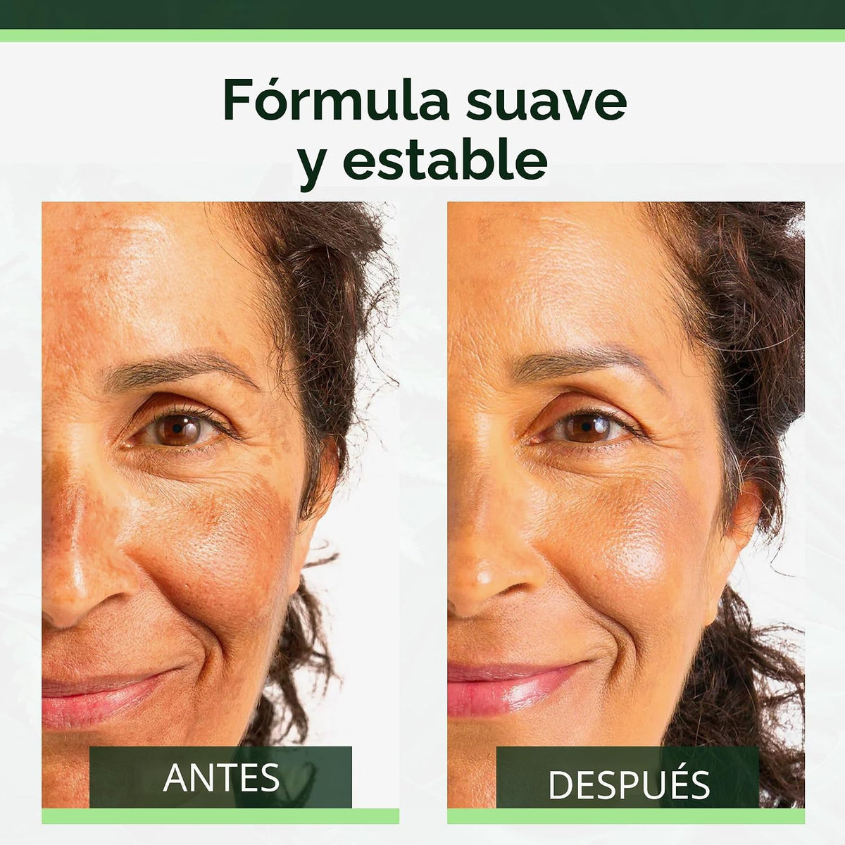 Suero de niacinamida Tree of Life para rostro, aceite facial para a...