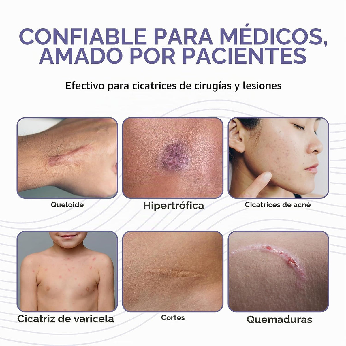 Kids Pro-Sil - Palo de silicona para cicatrices (0.15 oz) | Tratami...