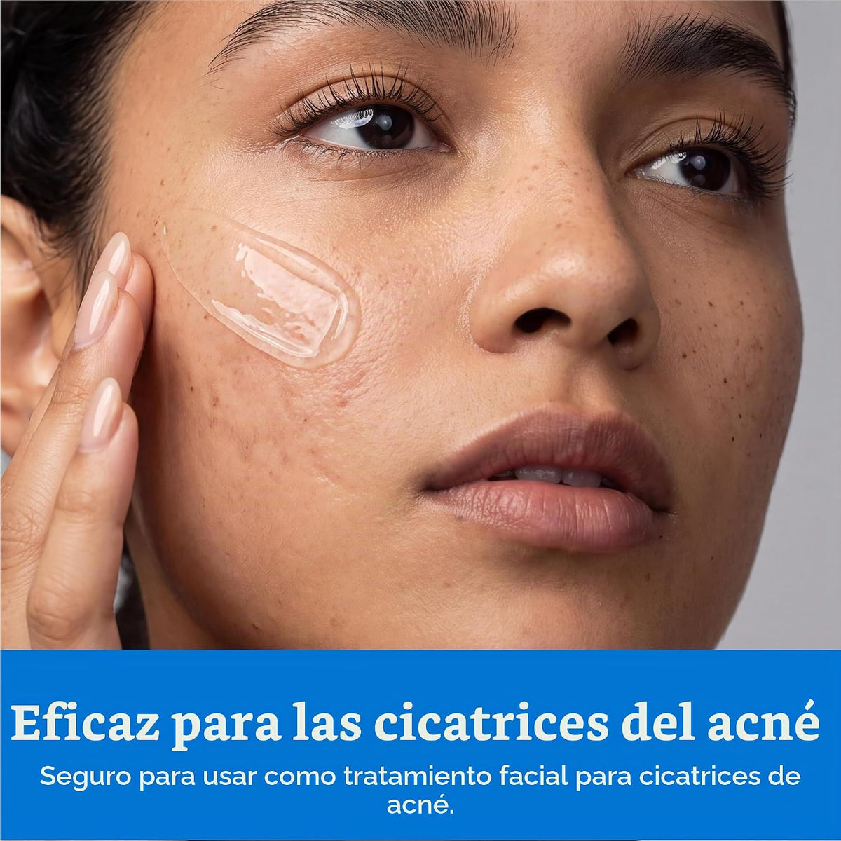 NUVADERMIS Gel de cicatrices para cicatrices quirúrgicas y cicatric...