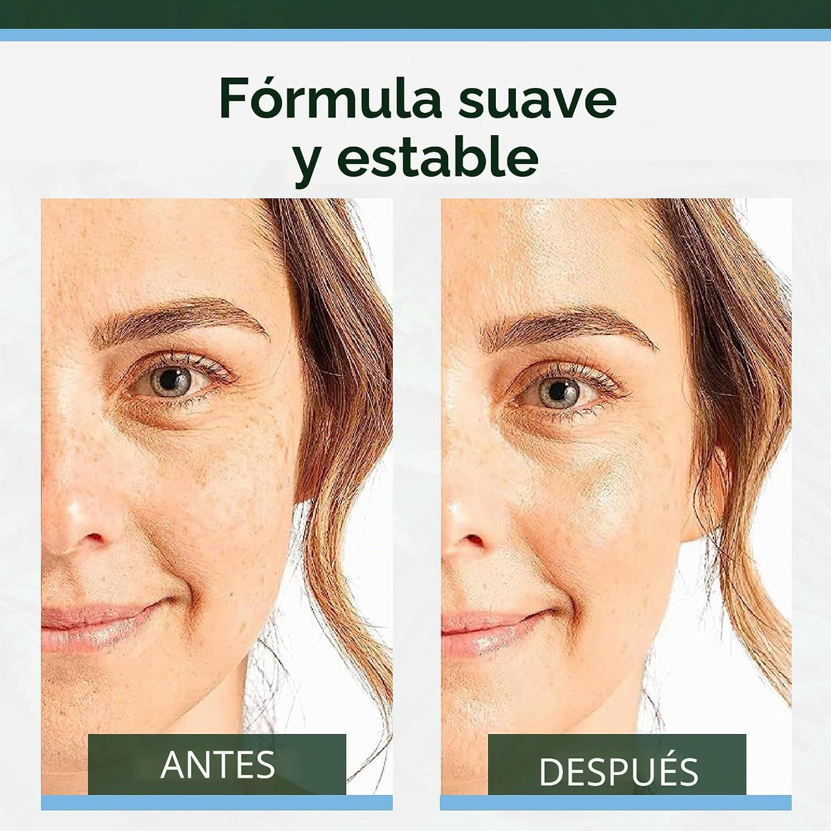Suero de ácido hialurónico Tree of Life para rostro, suero hidratan...