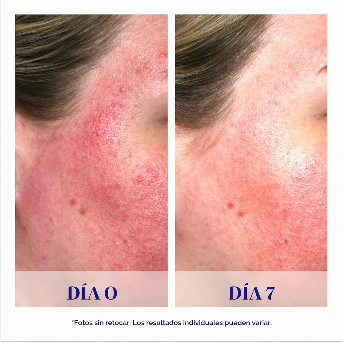 iS CLINICAL Pro-Heal Serum Advance+, suero rico en vitamina C antio...