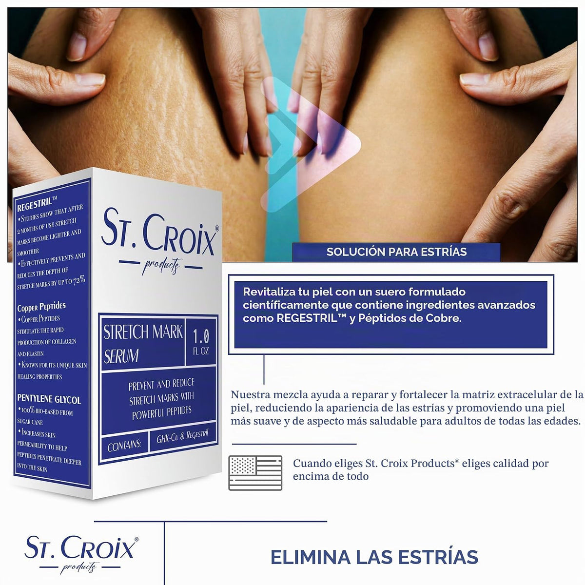 Sérum para estrías - Previene y reduce la aparición de estrías - 1 oz