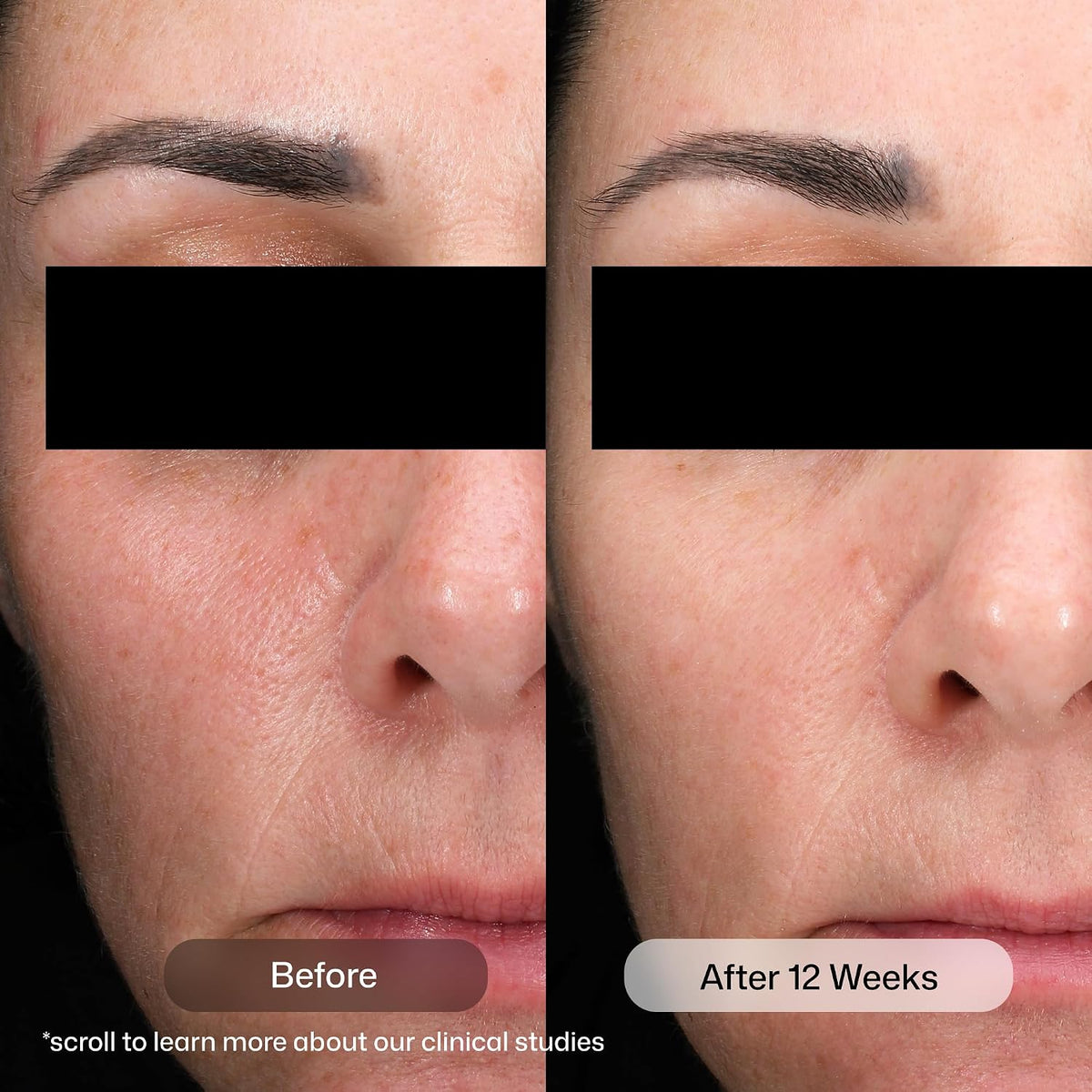 Revision Skincare D·E·J Daily Boosting Serum™, suero antienvejecimi...