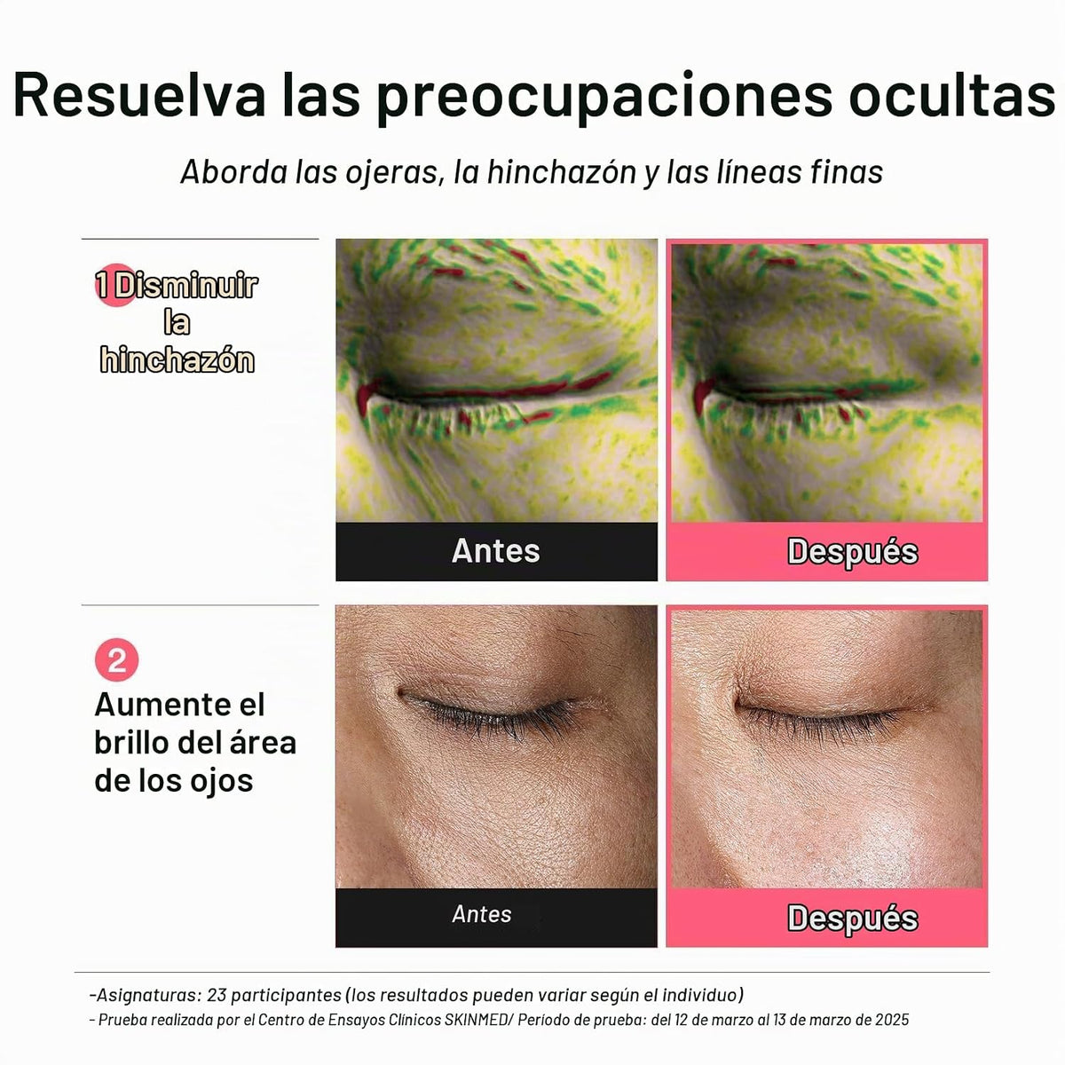 Abib PDRN - Parches para ojos retinianos para rejuvenecer e hinchar...