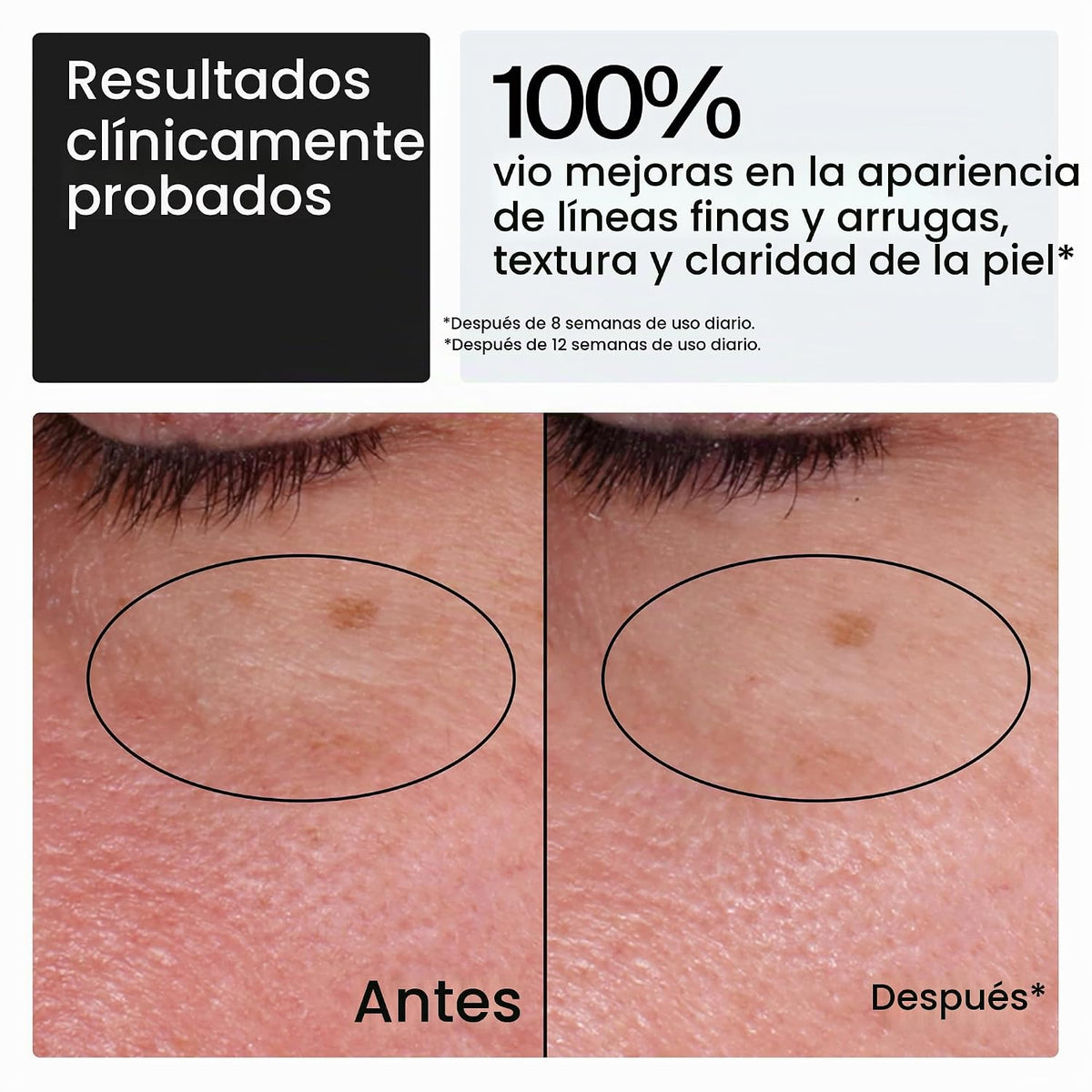 Neutrogena Hidratante facial de retinol de reparación rápida de arr...