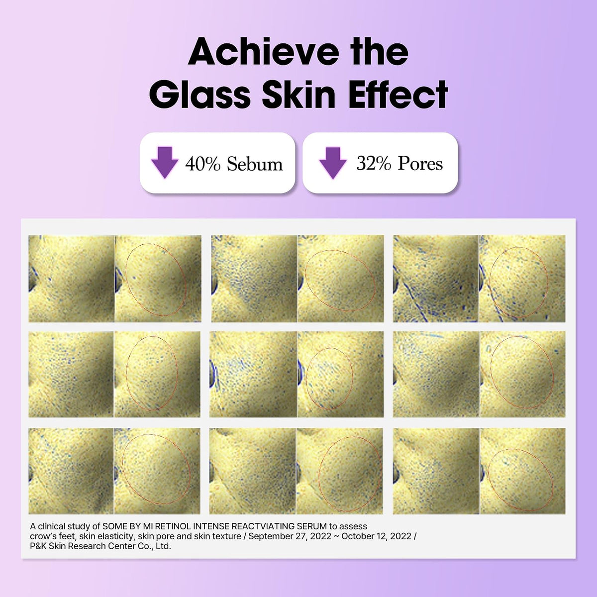 SOME BY MI Suero Reactivante Intensivo de Retinol \u2013 30ml, 1.01...
