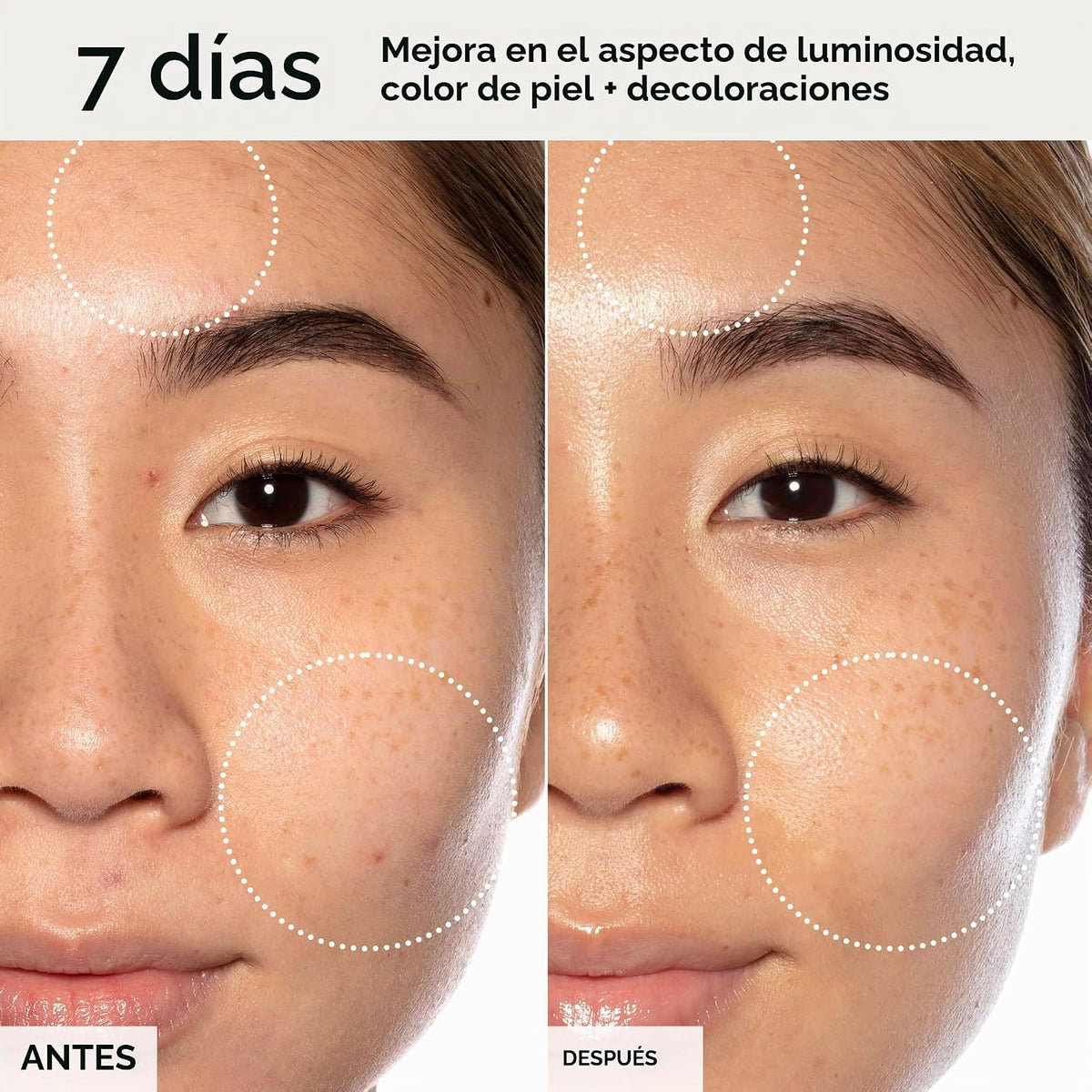 Suero Facial de Tratamiento de Ácido Láctico Todo en Uno de Sunday...