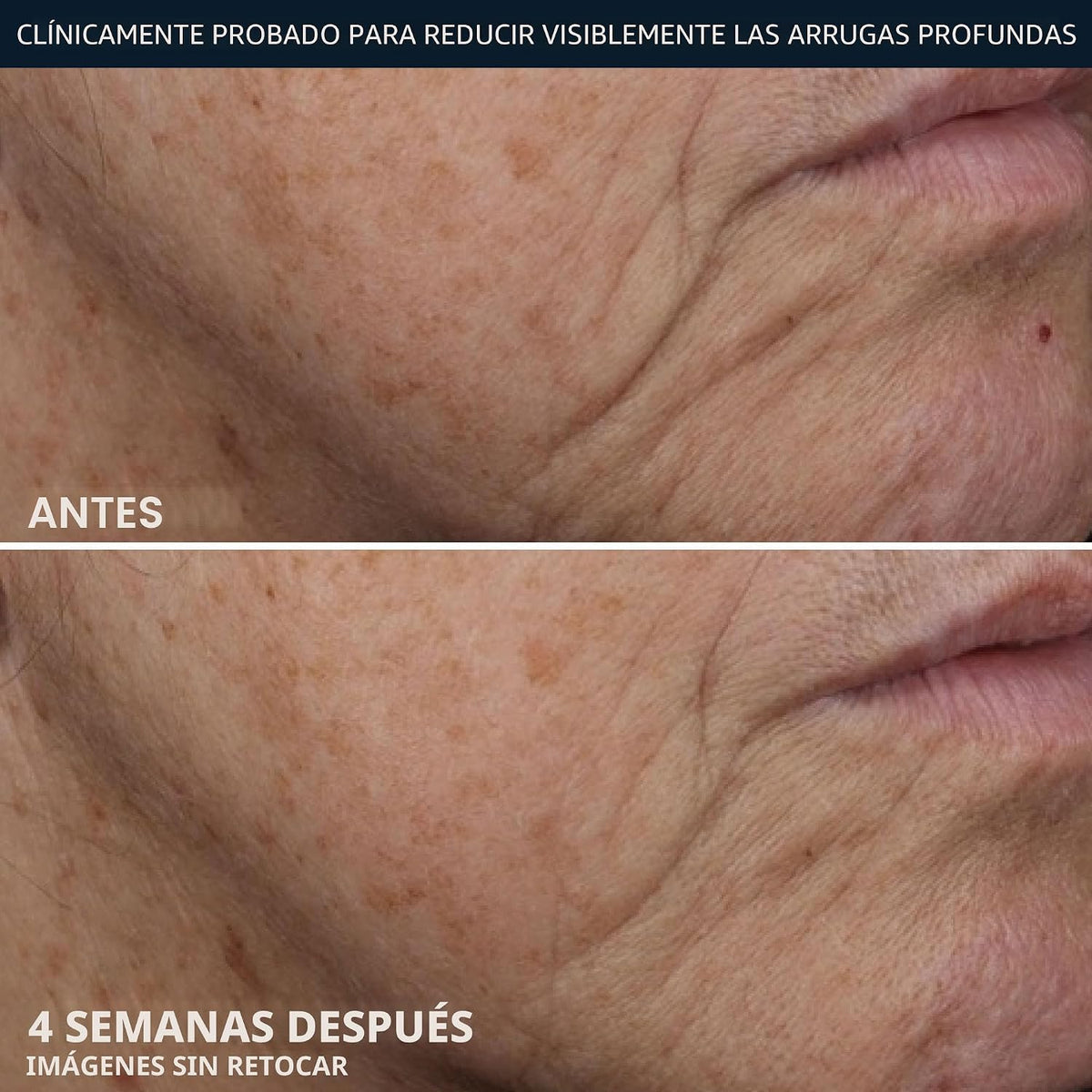 RoC Deep Wrinkle Rich Cream, crema reafirmante antienvejecimiento d...