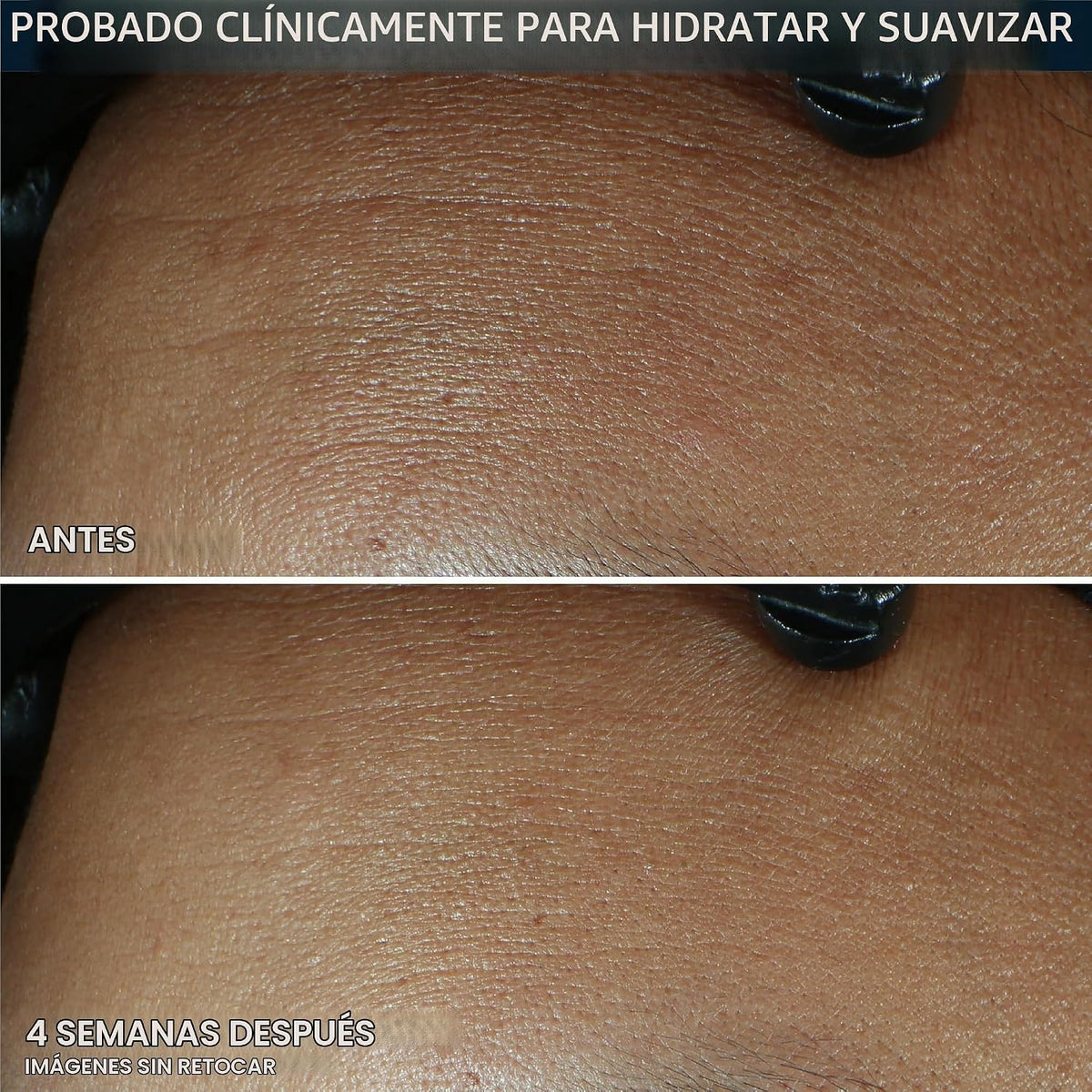 RoC Retinol Correxion Max Hydration - Hidratante facial diario anti...