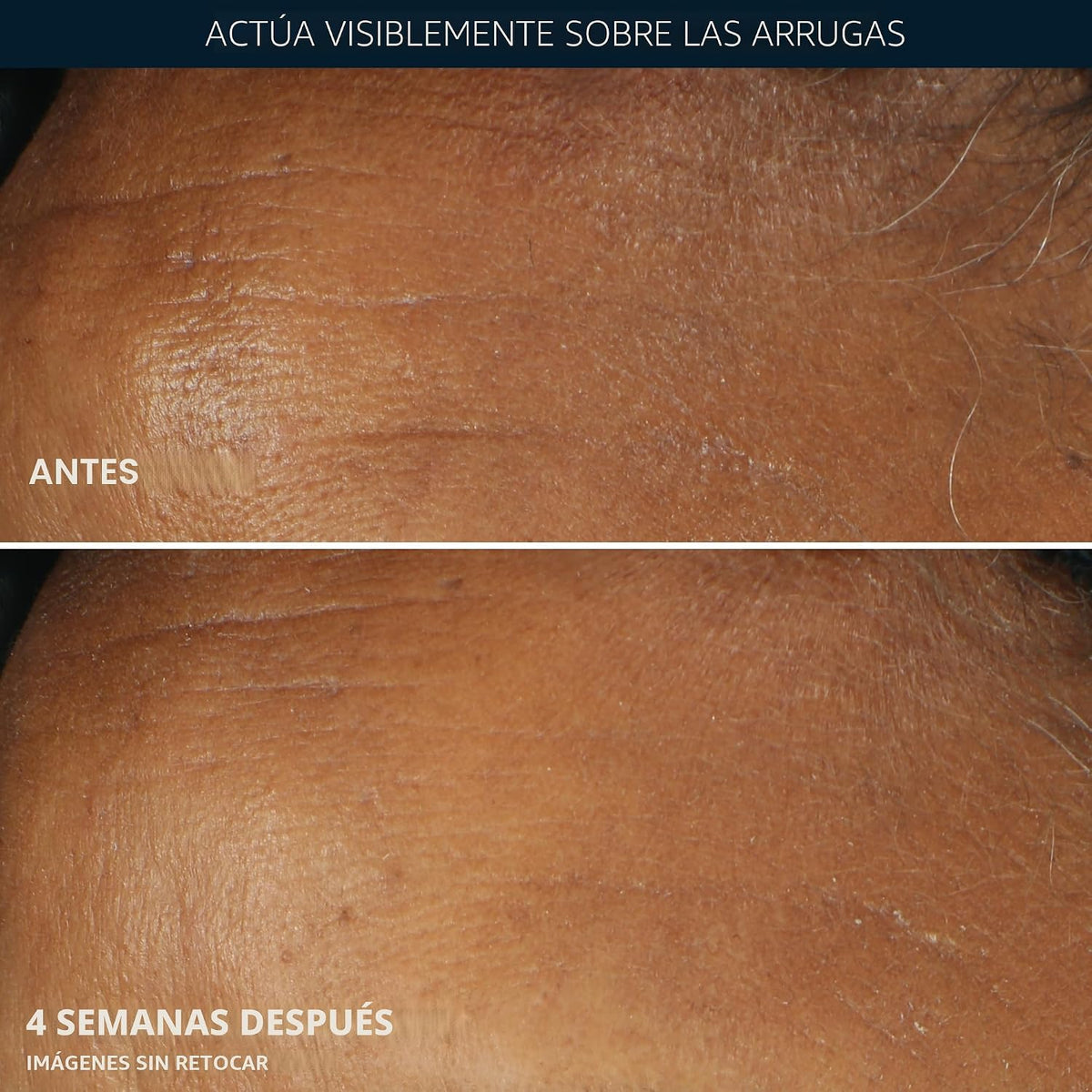 RoC Retinol Correxion Crema hidratante facial diaria para arrugas p...