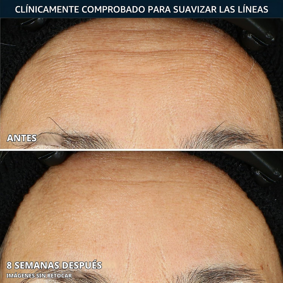 RoC Retinol Correxion Cápsulas de suero nocturno antienvejecimiento...