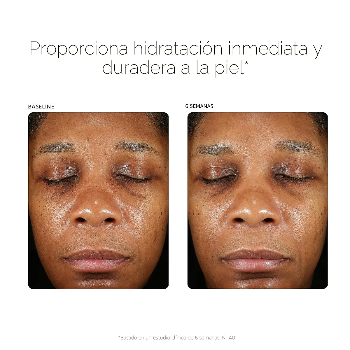 PCA SKIN Suero potenciador de ácido hialurónico para la cara - Corr...