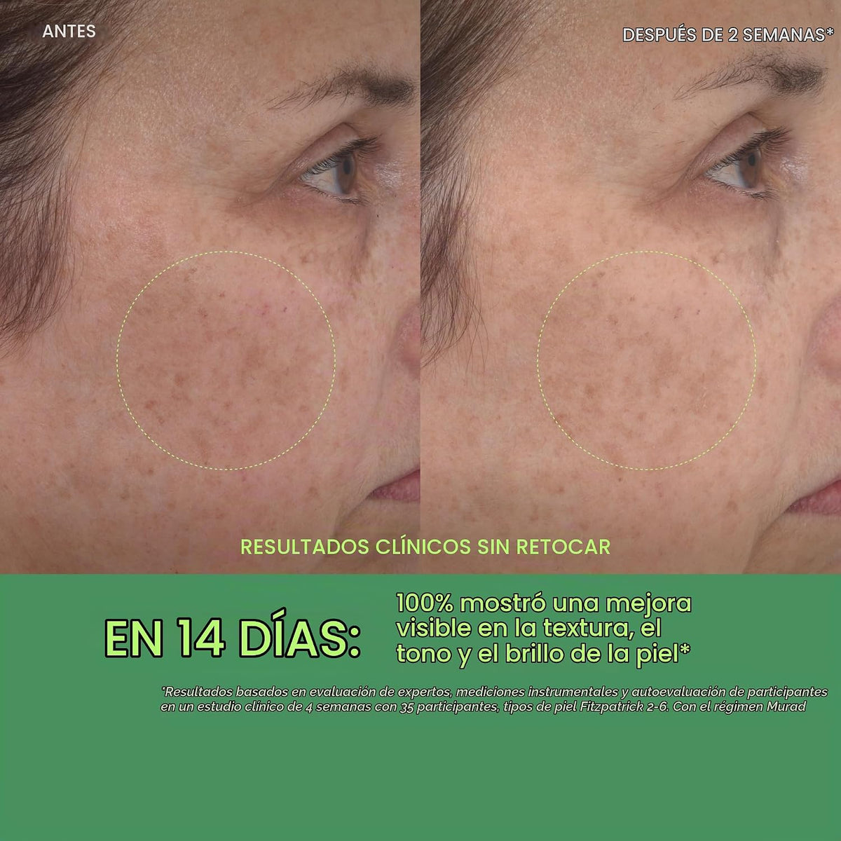 Suero renovador juvenil Murad Retinol - Tecnología avanzada de reti...