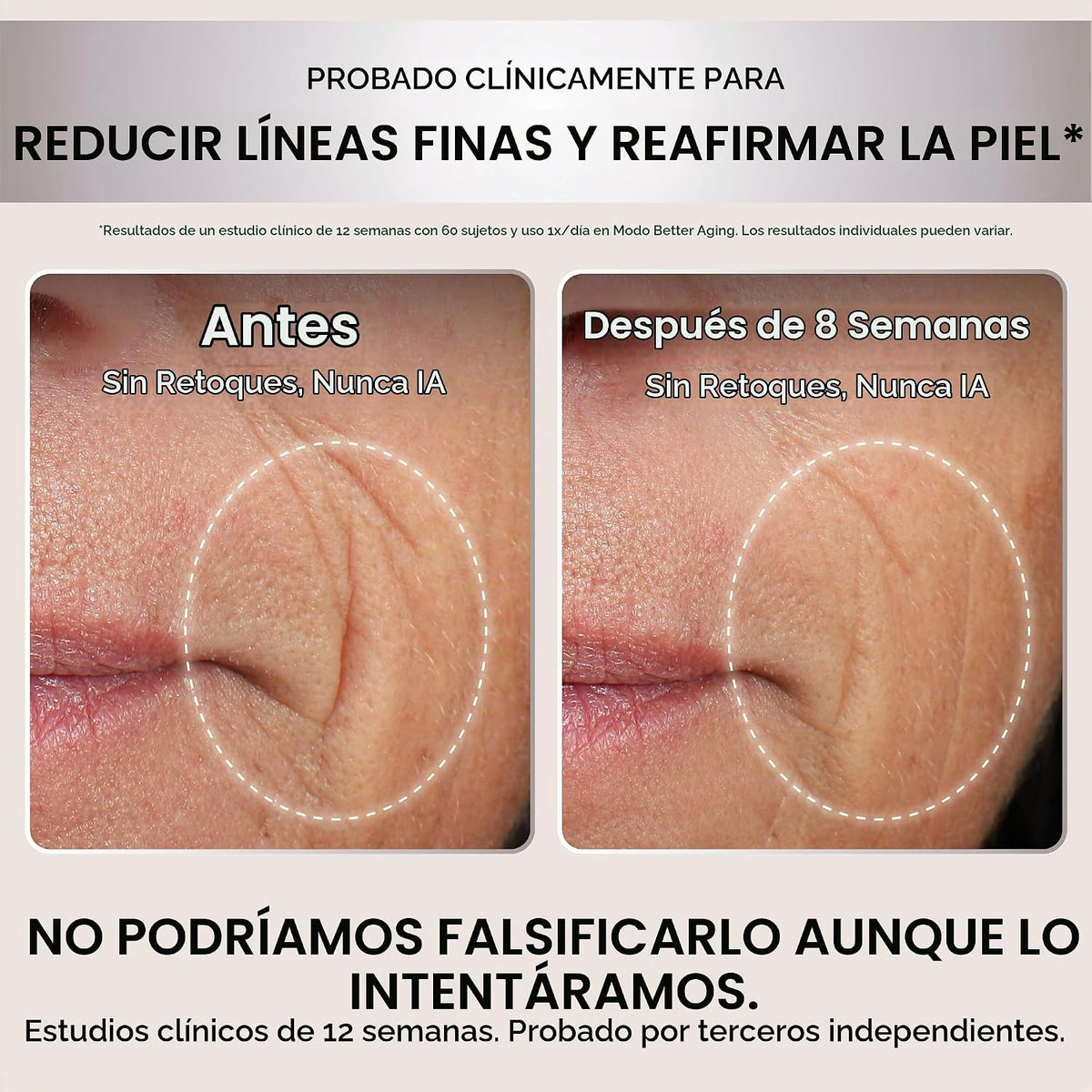 Mascarilla facial LED Shark CryoGlow, terapia de luz roja, enfriami...