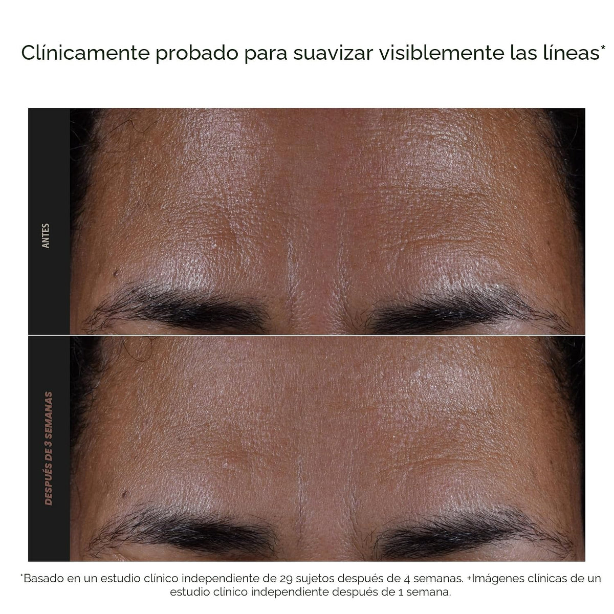 Paula's Choice SKIN PERFECTING 2% BHA Exfoliante líquido sin enjuag...